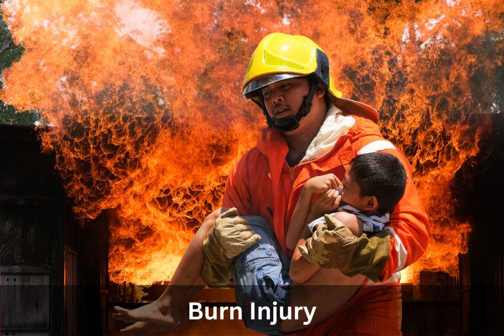 Charlottesville Burn Injury Lawyer Charlottesville Virginia Laws